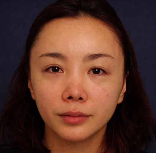 Before/After Image